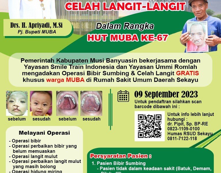 Beri Senyuman Baru Tanpa Keminderen Lewat Operasi Bibir Sumbing Gratis
