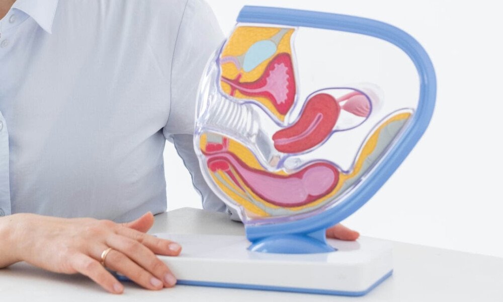 Mengenal PCOS: Gangguan Hormonal yang Mempengaruhi Kesuburan dan Kesehatan Perempuan